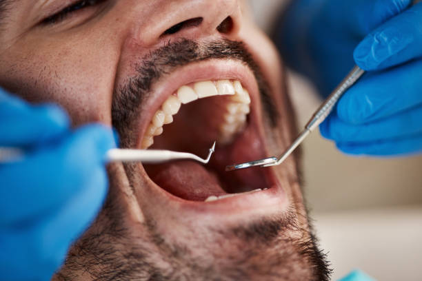 Best Broken or Cracked Tooth Emergency Dentist in Swedeland, PA